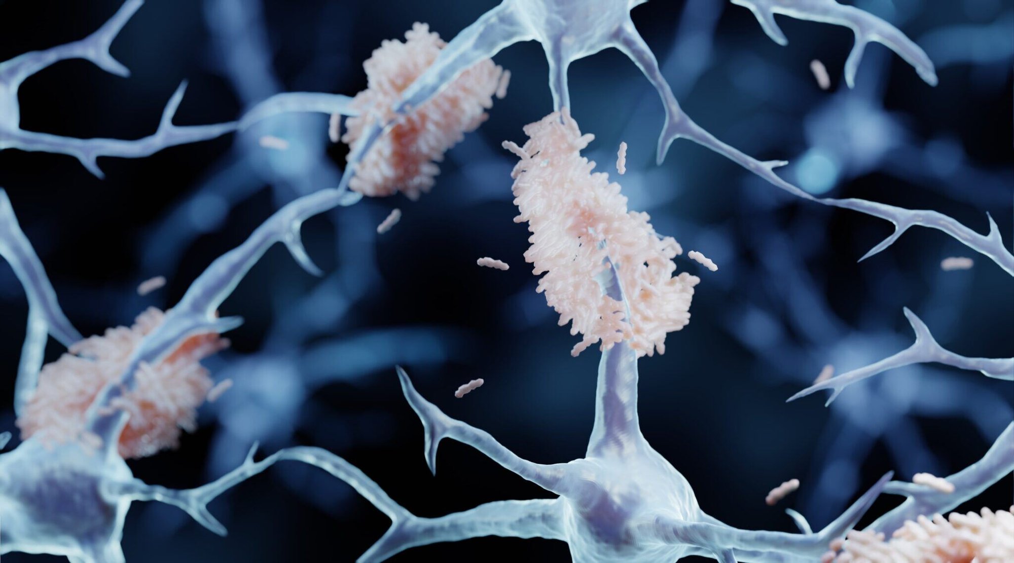 amyloid-plaque-forming-between-neurons-2048x1138